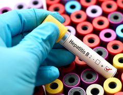 Вірусний гепатит В